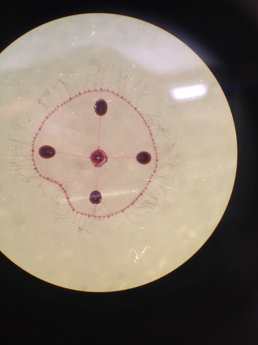 <p>What structure is being pointed to? (dark circles around obeila)</p>