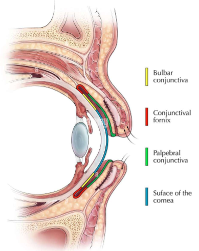 <p>potential space between palpebral conj and bulbar conj</p>