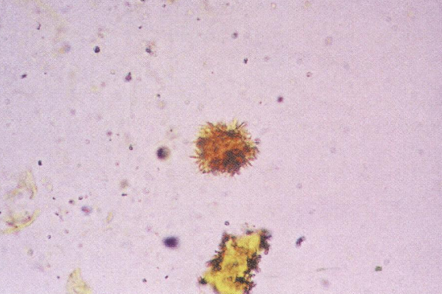 <p>What are these?</p>