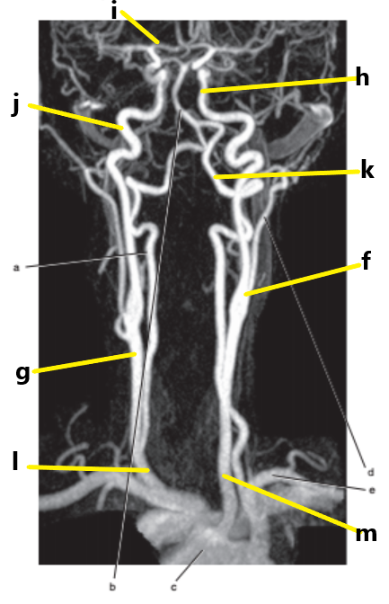 <p>What is letter f ?</p>