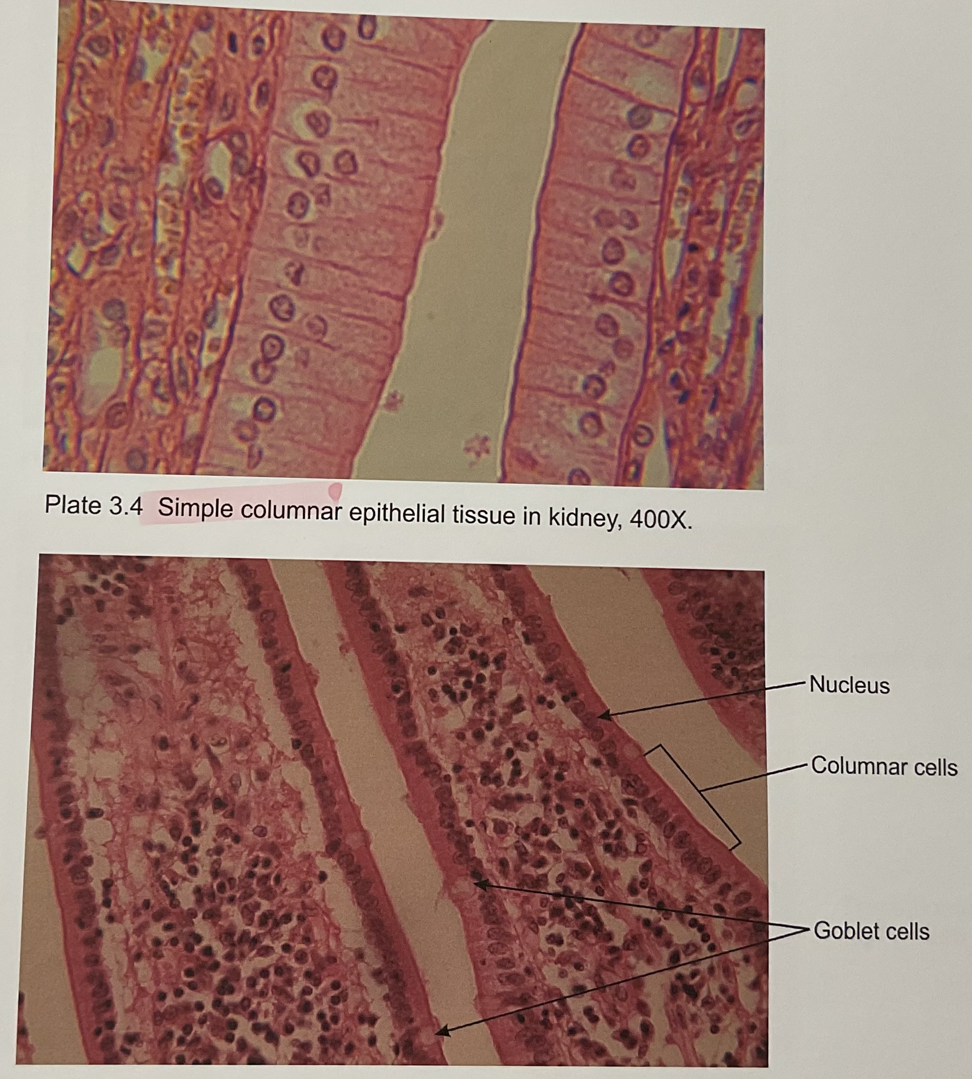 <p>Simple Columnar </p>