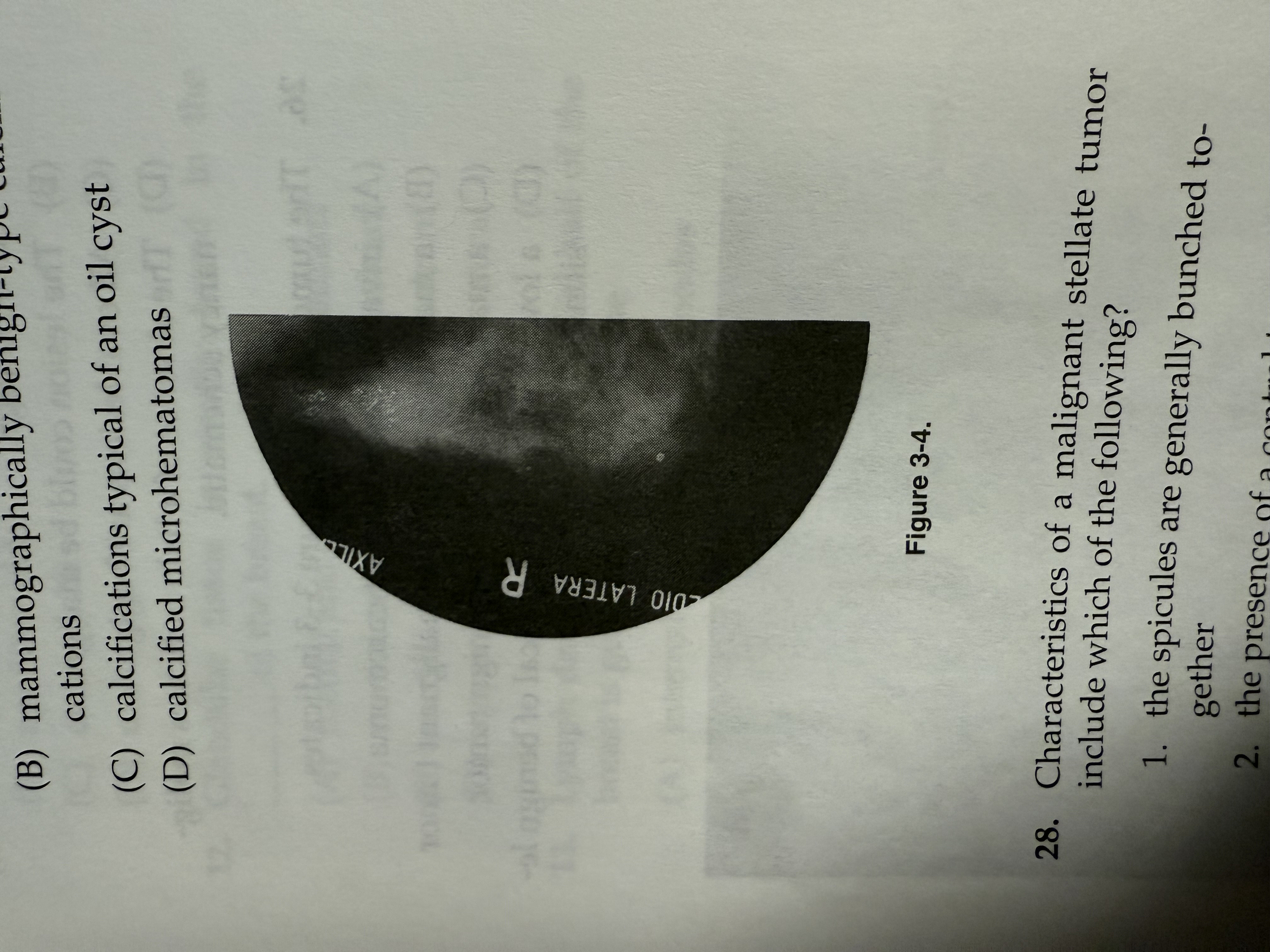 <p>The calcifications seen in Figure 3-4 have the typical appearance of</p><ol><li><p>﻿﻿﻿﻿mammographically malignant-type calcifications</p></li><li><p>﻿﻿﻿﻿mammographically benign-type calcifications</p></li><li><p>﻿﻿﻿﻿calcifications typical of an oil cyst</p></li><li><p>﻿﻿﻿﻿calcified microhematomas</p></li></ol>