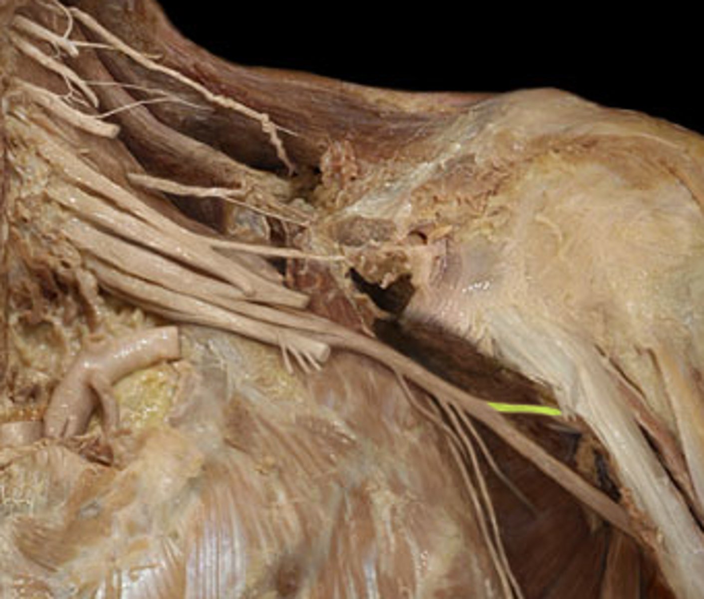 <p>Shoulder flexion</p>