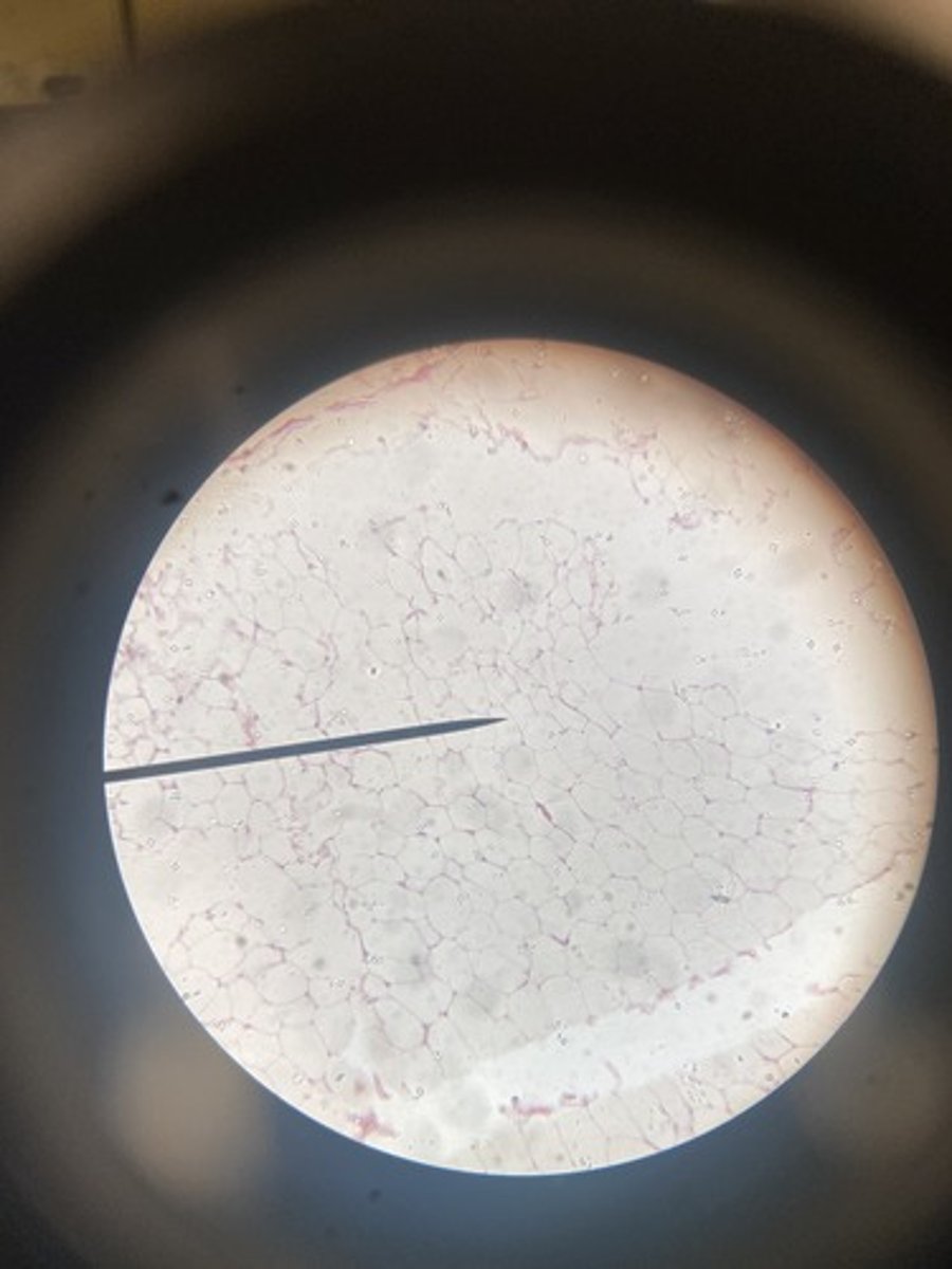 <p>What type of tissue</p>