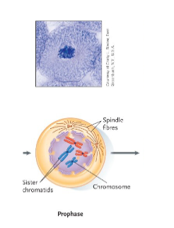 <p>Mitosis – Prophase</p>