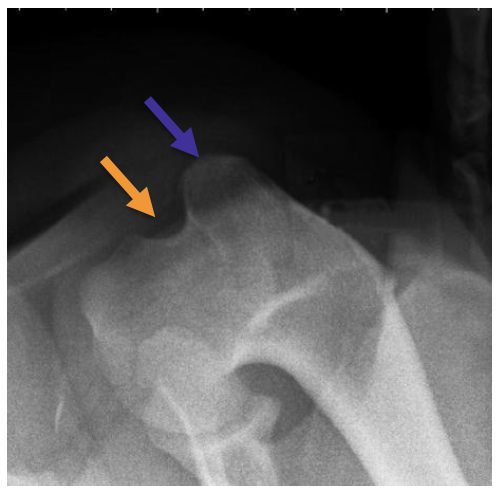 <p>what is the orange arrow pointing to?</p>