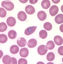 <p>Dr. Vicente Y. Belizario Jr.</p>