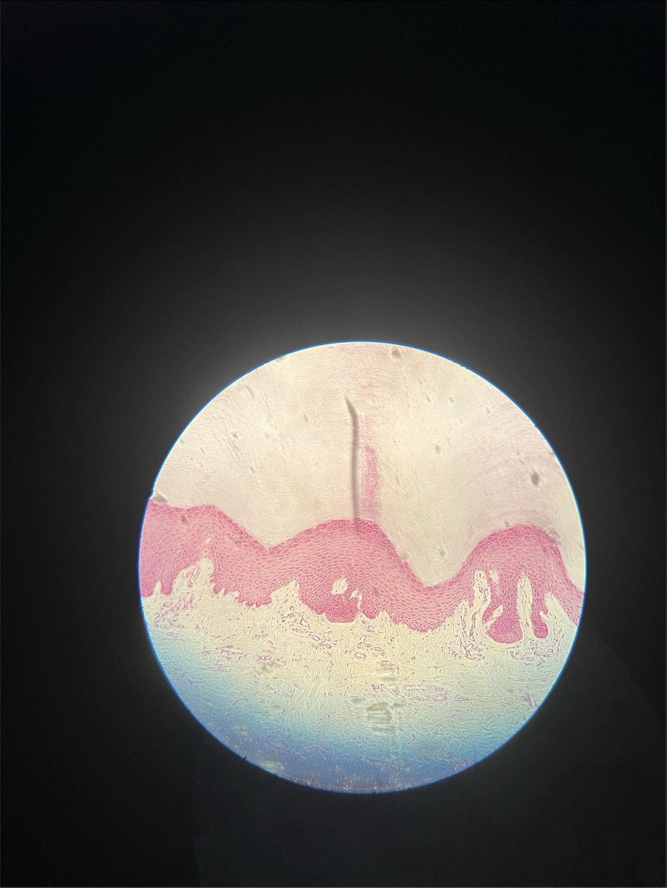 <p>what specimen is this?</p><p>identify the stratum corneum</p>