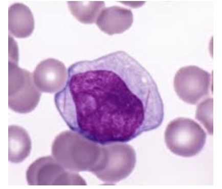 <p><span style="font-family: Helvetica; font-size: 12px;">Which of the following is FALSE about this stage of myeloid development?</span></p><p><span style="font-family: Helvetica; font-size: 12px;">a. They may contain Auer rods in the cytoplasm</span></p><p><span style="font-family: Helvetica; font-size: 12px;">b. They typically have no nucleoli present in the nucleus</span></p><p><span style="font-family: Helvetica; font-size: 12px;">c. ﻿﻿﻿They have a delicate chromatin pattern</span></p><p><span style="font-family: Helvetica; font-size: 12px;">d. ﻿﻿﻿They are classified as myeloblasts</span></p><p></p>