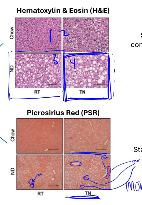 <p>to test mouse models, if ND &amp; TN offer best resemblance to MASH in humans, and it did</p>