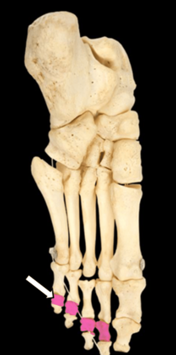 <p>name the part</p>