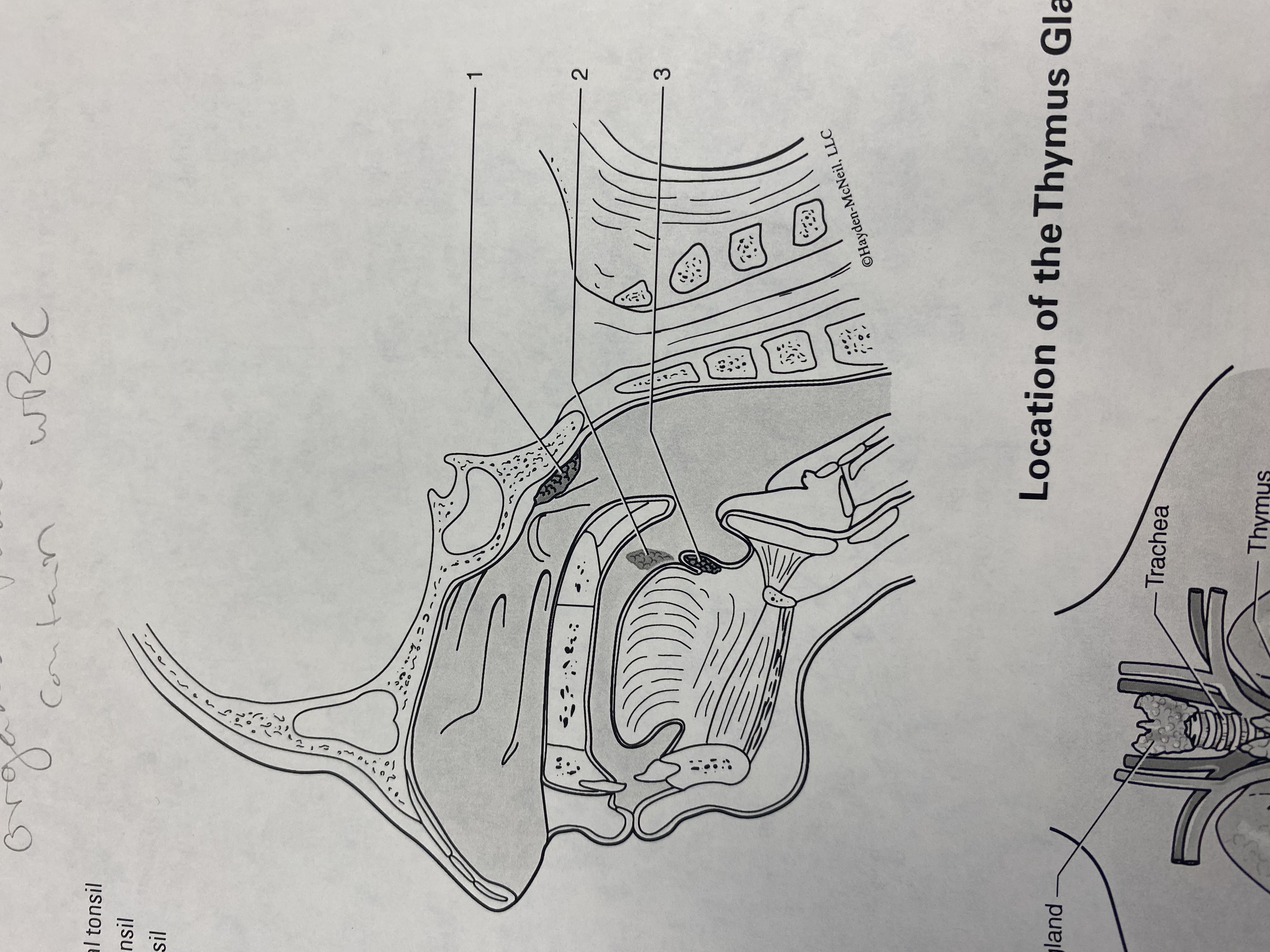 <p>#3?</p>