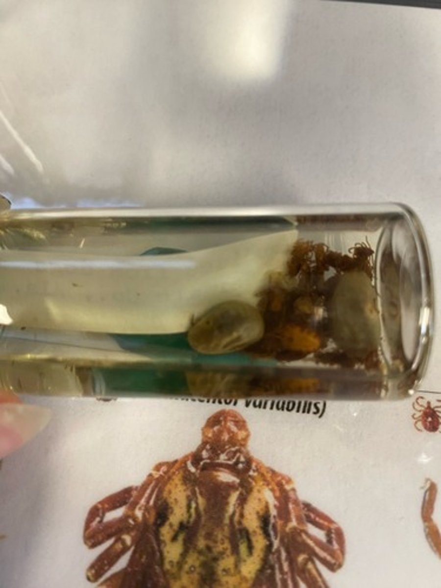 <p>What subphylum is this organism in?</p>