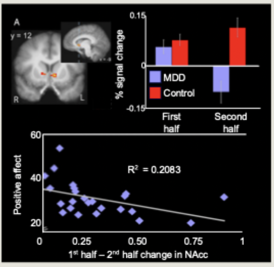 <ul><li><p>depression patients failed to sustain nucleus accumbens activation when amplifying, with deficits specific to positive emotion</p></li><li><p>patients who failed to sustain NAcc activity reported less intense positive emotion</p></li></ul><p></p>