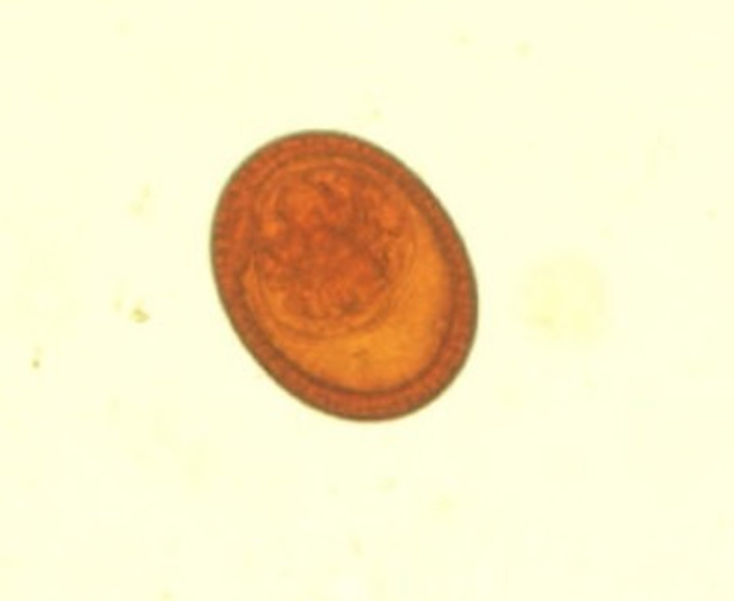 <p>Identify the parasite</p>