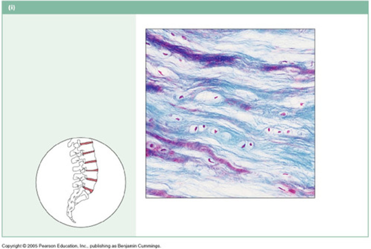 <p>Highly compressible. Forms cusion-like discs between vertebrae.</p><p>Matrix: less firm than Hyaline Cartilage Connective Tissue that contains collagen (fibers are evident)</p>