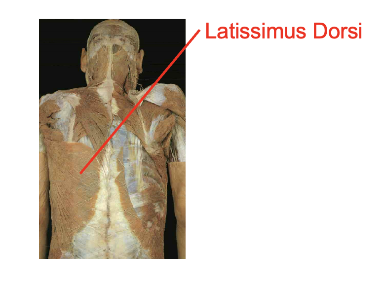<p>latissimus Dorsi</p><p></p><p>Origin:</p><ul><li><p>Spinous process of T7-T12</p></li><li><p>lower ribs</p></li><li><p>Thoracolumbar aponeurosis</p></li><li><p>iliac Crest</p></li></ul><p>Insertation</p><ul><li><p>Bicipital Groove of humerous</p></li></ul><img src="https://knowt-user-attachments.s3.amazonaws.com/e0791f81-611e-447b-bac8-288b6ab790ca.png" data-width="100%" data-align="center"><p></p>