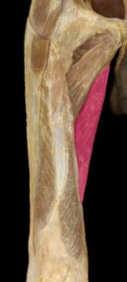 <p>medial on thigh, behind gracilis</p>