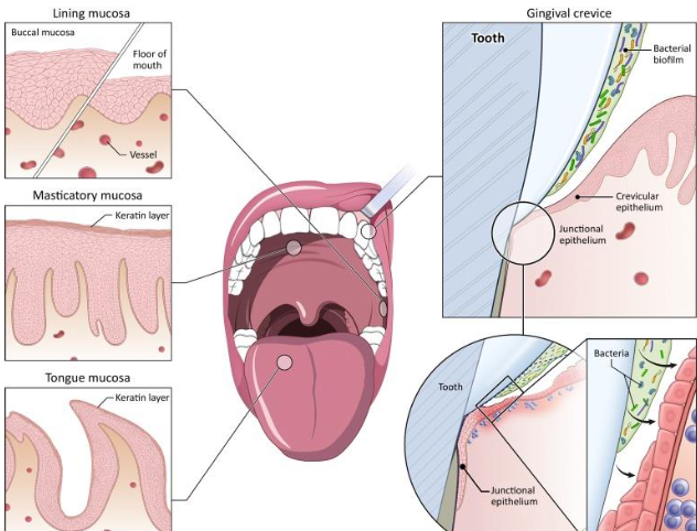 <p>oral epithelium is always wet</p><p>typically keratinized (resistant to water) </p><p><strong>Junctional epithelium</strong>-bottom of pocket (sulcus); lacks keratinization and is most susceptible to bacterial invasion</p><p><strong>Three main connective tissue/lamina propria</strong>: </p><p>lining, masticatory, specialized </p>