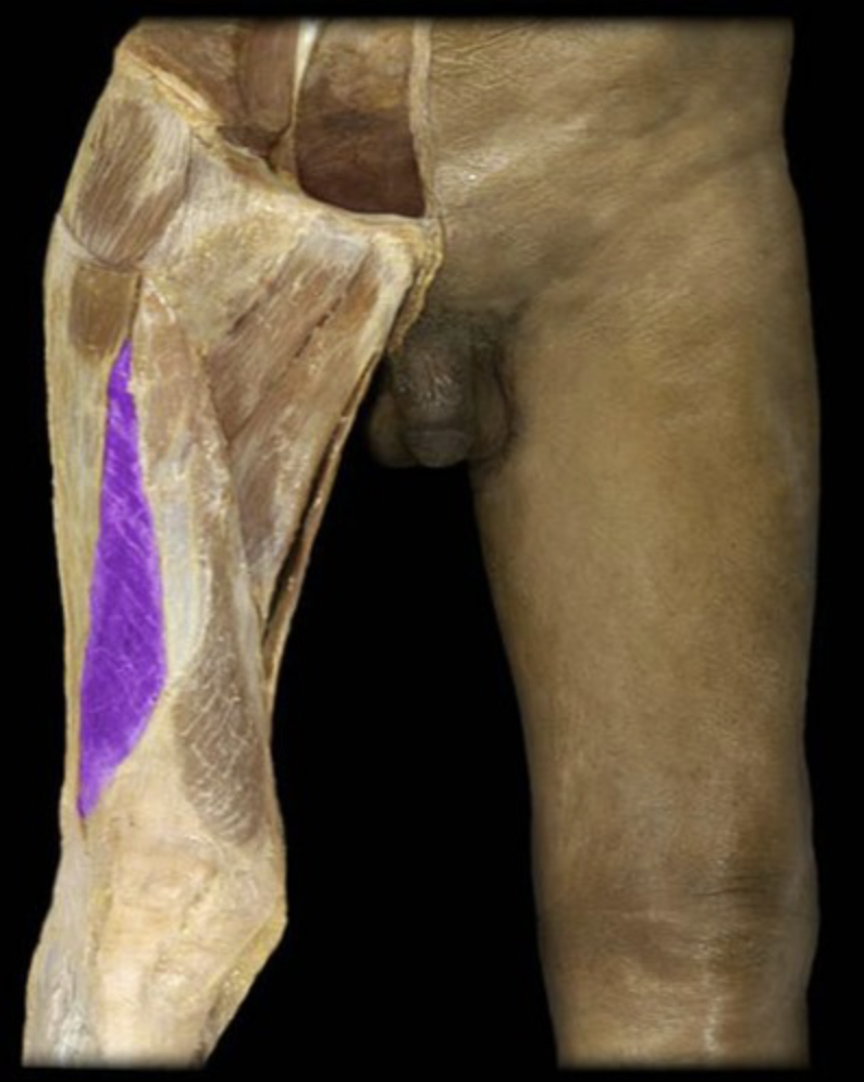 <p><em>Quadriceps muscle, table 5, 7</em></p>