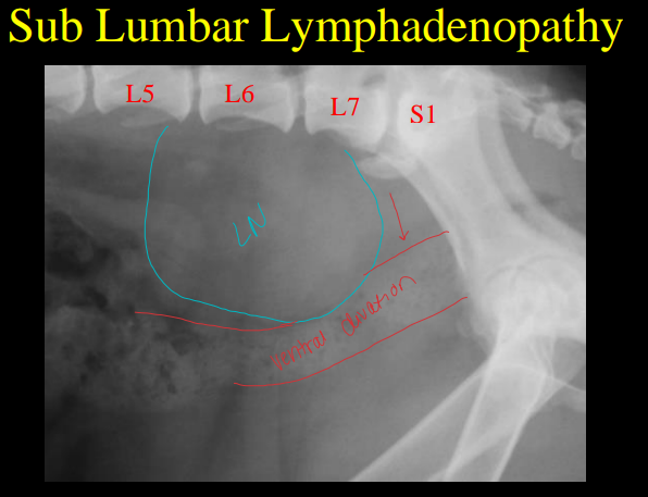 <p>Lymph node disease on Radiographs </p>