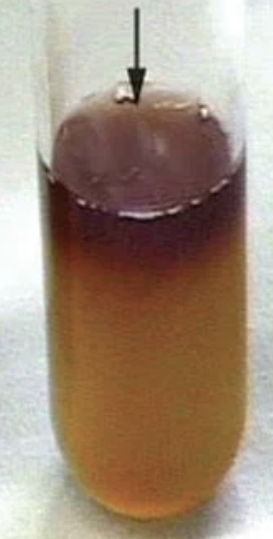 <p>Is this a positive or negative VP test?</p>