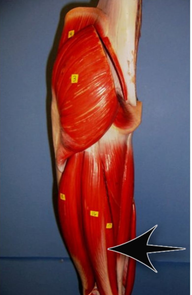 <p>Origin - ischial tuberosity<br>Insertion - medial condyle of tibia<br>Action - extends thigh and flexes knee<br>Description - deep to semitendinosus</p>