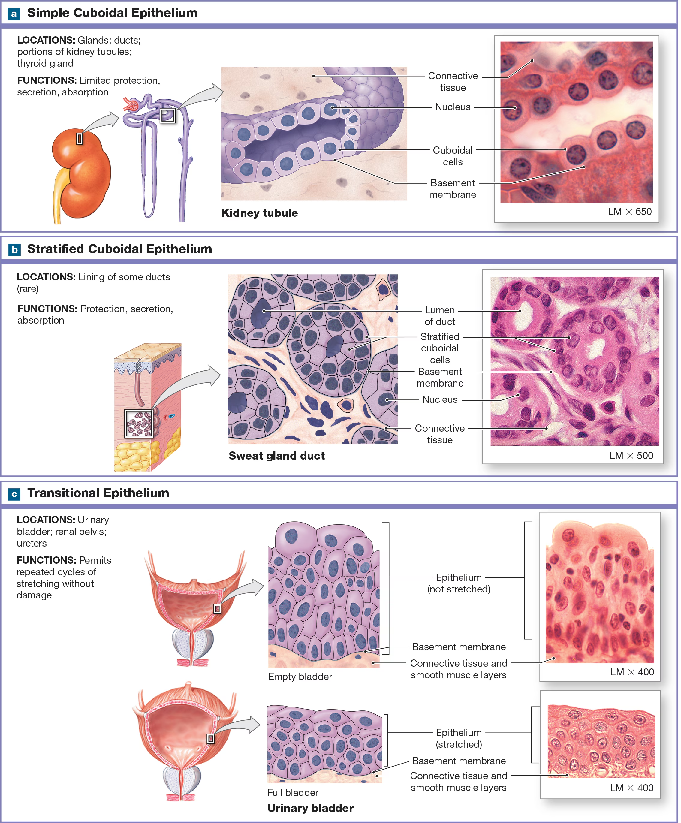 <p>Stratified but not classified by shape because its cells can change shape (apical = dome-shaped, but when stretched its flattened and appear squamous). Found in the urinary bladder and ureters </p>
