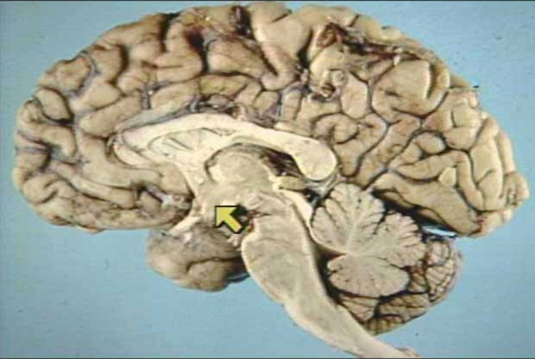 <p>What is the arrow pointing at?</p>