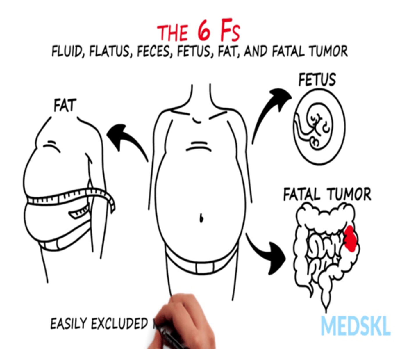 <p>(the 6 F's--Fluid, Flatus, Feces, Fetus, Fat, Fatal Tumor)</p><p>Obesity</p><p>Air or gas</p><p>Ascites</p><p>Ovarian cyst</p><p>Pregnancy</p><p>Feces</p><p>Tumor</p>