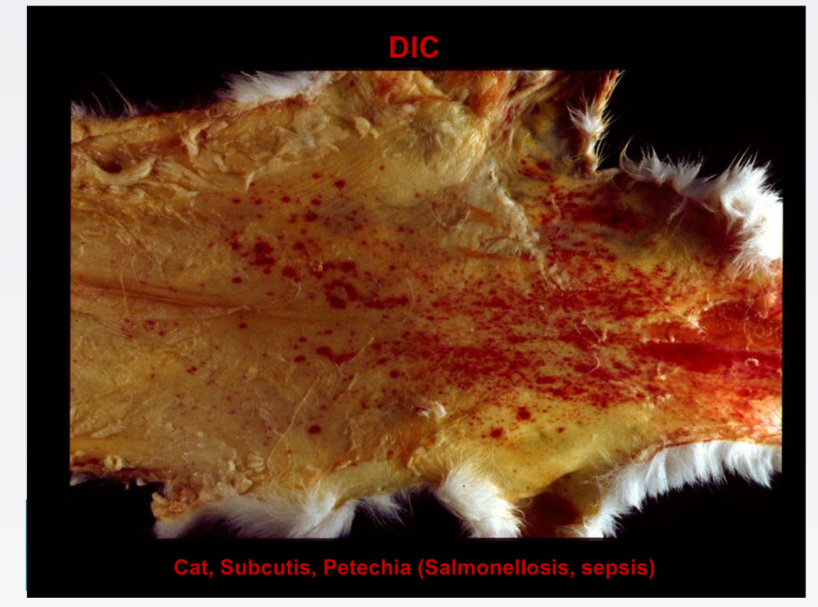 <p>Bacterial endotoxins → monocytes release tissue factor + pro inflammatory cytokines → endothelial cells increase expression of tissue factor, decrease expression of thrombomodulin → activate clotting cascade, inhibit clotting control </p>