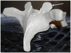 Name this specific part of the thoracic vertebra.