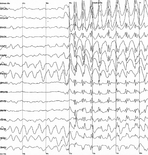 <p>Brain waves</p>