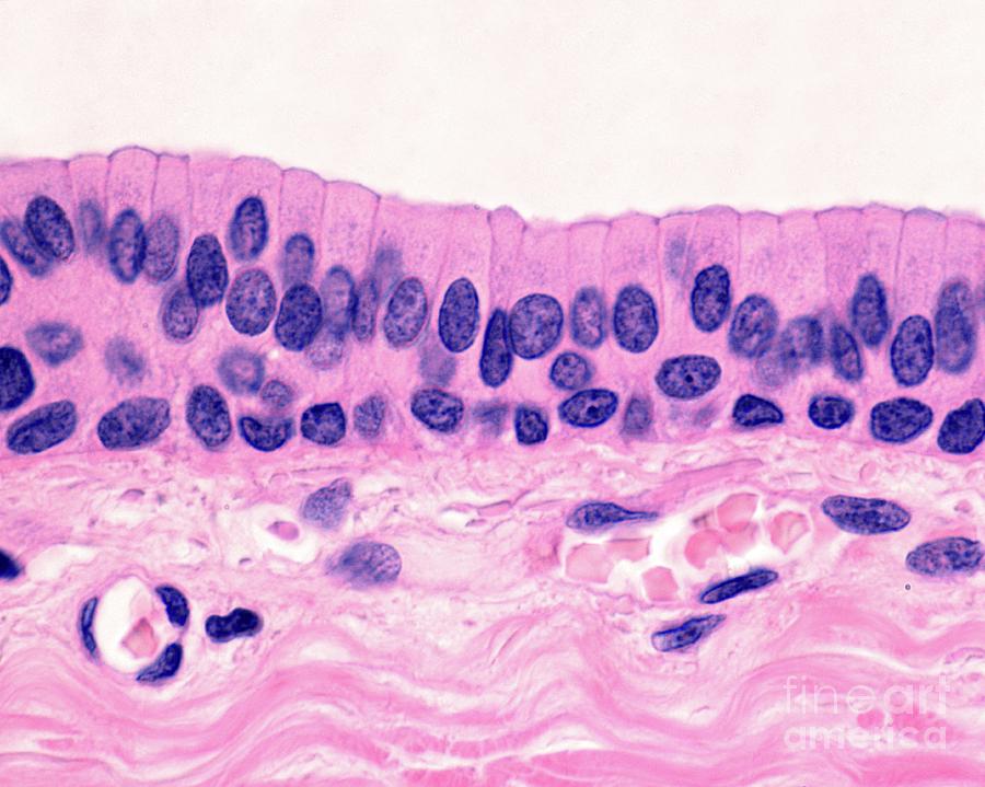 <p>Stratified Columnar Epithelium — Description</p>