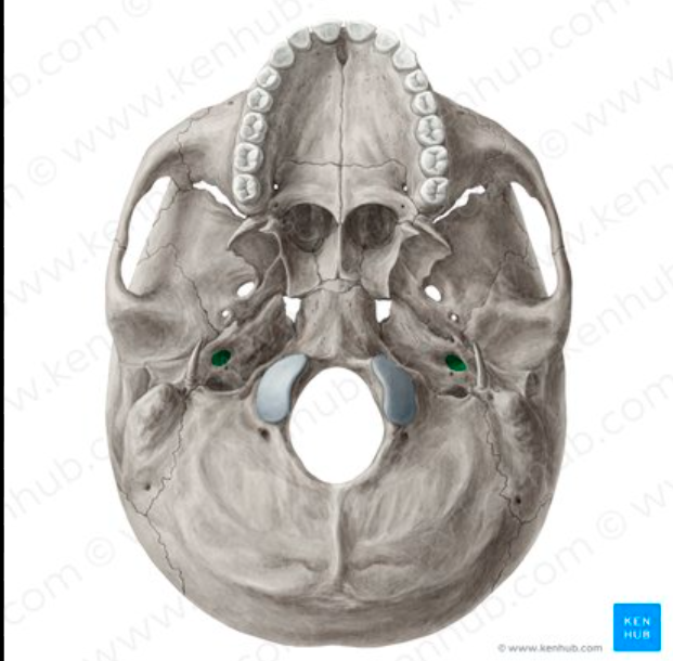<p>What landmark in the <strong>Temporal Region </strong>is this?</p>