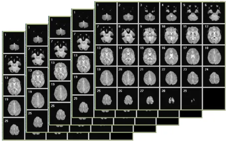 <ul><li><p>Differences for functional imaging:</p><ul><li><p>Focus on oxygenated vs deoxygenated blood.</p><ul><li><p>More active brain area → more oxygen flowing through blood.</p></li><li><p>Oxygenated blood is less magnetic → bigger MR signal.</p></li></ul></li><li><p>Measure time-course</p><ul><li><p>Take image of brain every 1 -3 sec</p></li><li><p>Look at changes over time</p></li></ul></li></ul></li><li><p>Collect entire scan of the brain (in slices) every ~2 seconds</p></li></ul><p></p>