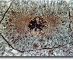 <p>first and longest phase of mitosis, during which the chromosomes become visible and the centrioles separate and take up positions on the opposite side of the nucleus</p>