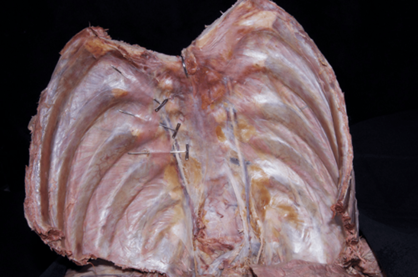 <p>-found on the underside of the sternum</p><p>-anchors the ribs to the sternum</p><p>-fan-like</p>