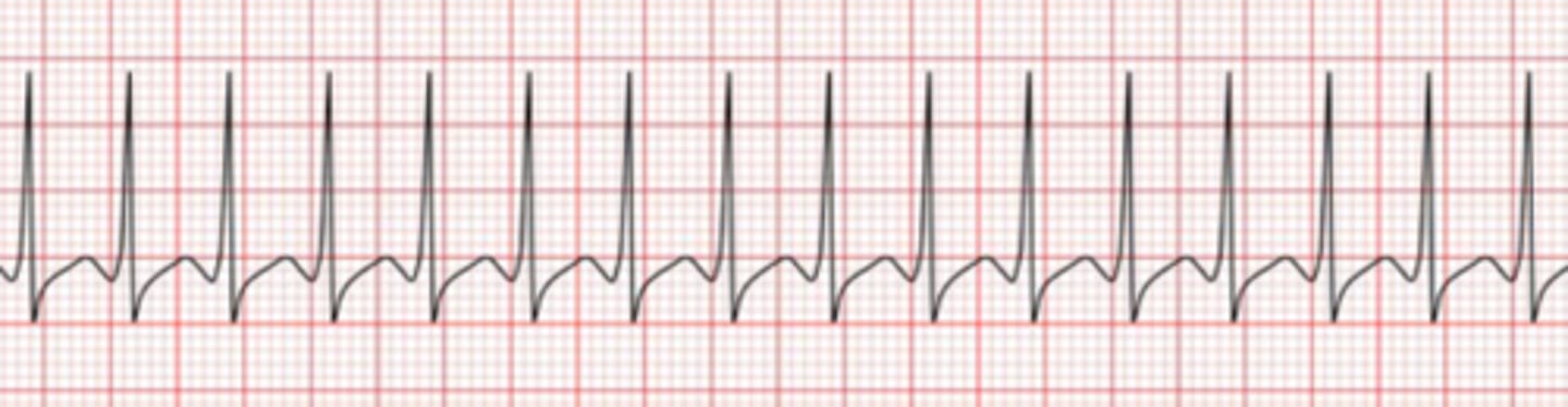 <p>Name the rhythm</p>