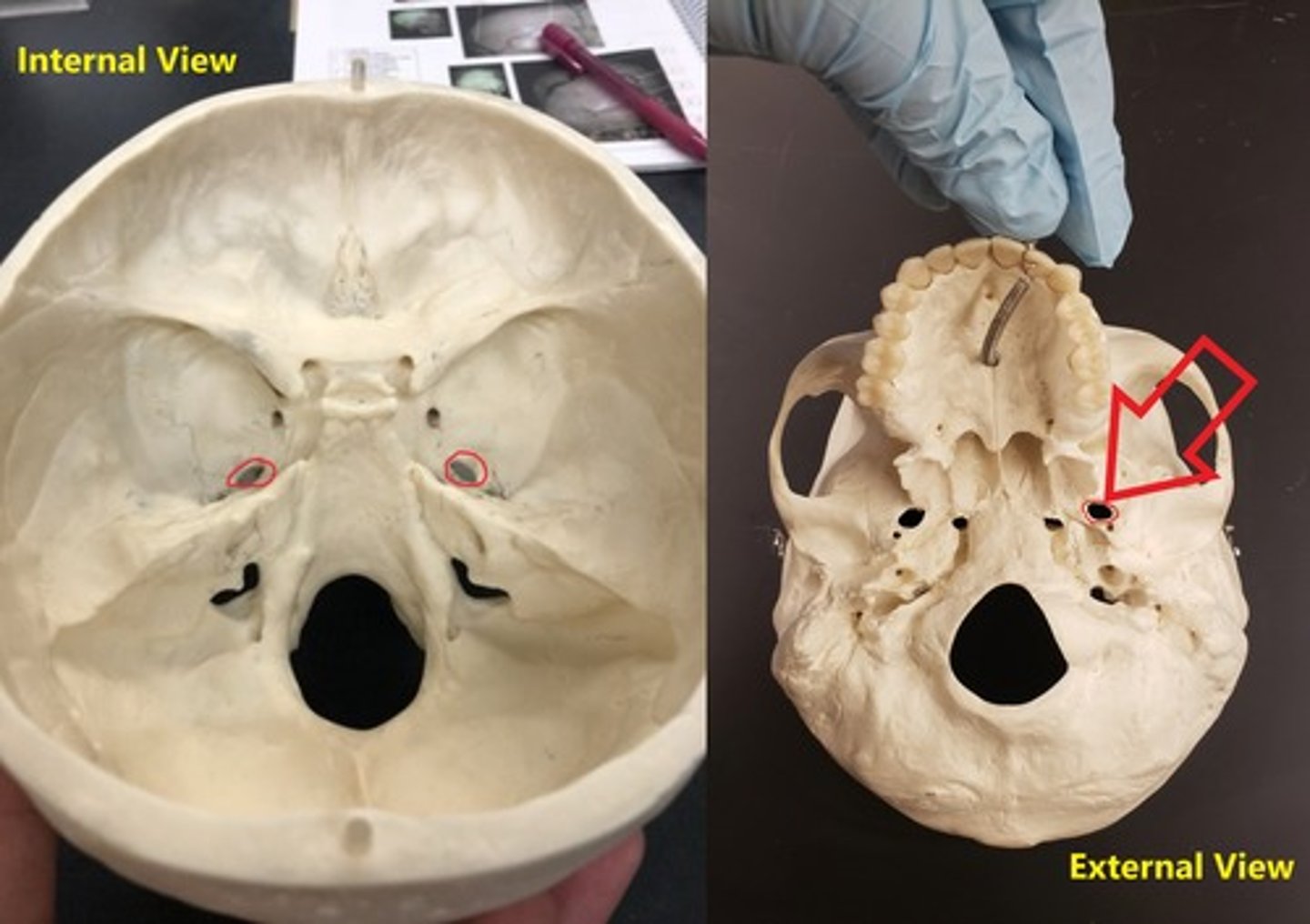 <p>A bigger looking oval; before the foramen spinosum</p>