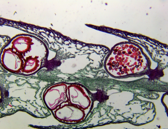 <p>megaspores are the larger female ones (farthest left)</p><p>microspores are the smaller male ones (farthest right) </p>