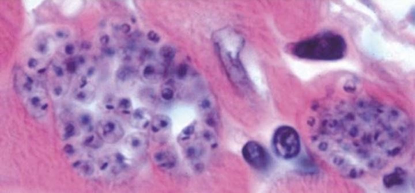 <p>Identify the parasite that produced the little nest of amastigotes seen in this histopath section of heart muscle from a dog that died of cardiac disease in Texas.</p>