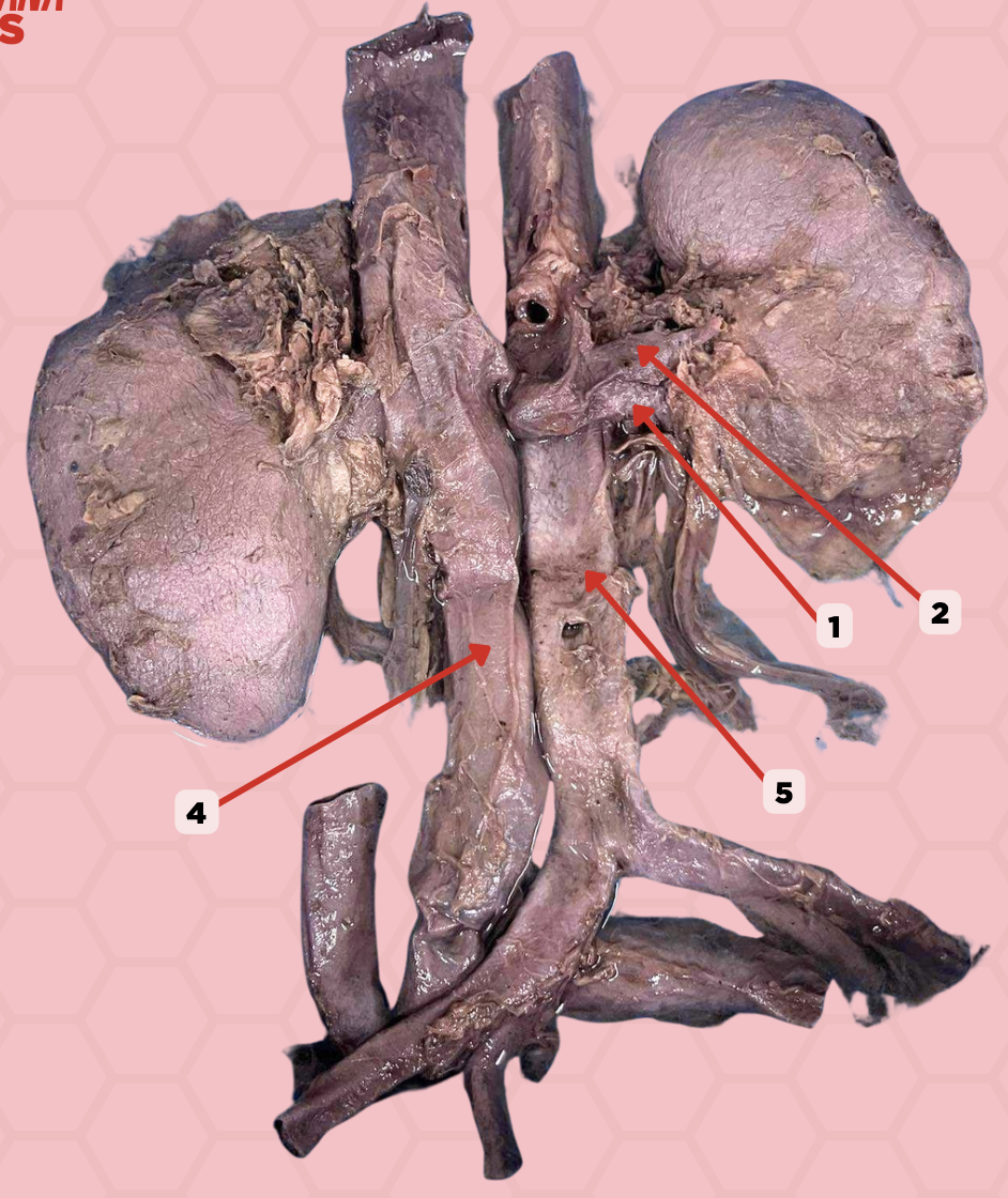 <p>Identify the structure labeled as 5.</p>