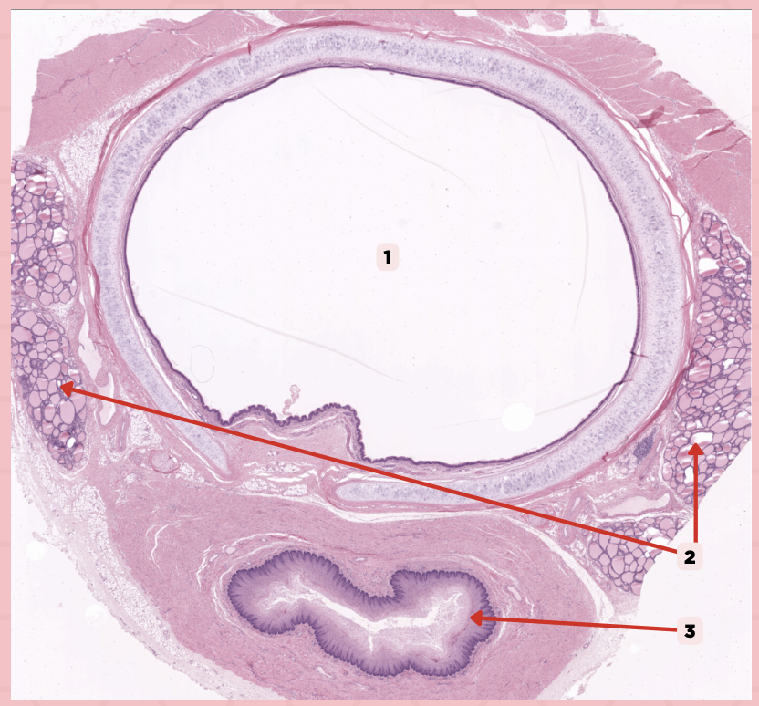 <p>This consist of cystic structures that contain highly eosinophilic material on either side of the trachea.</p>