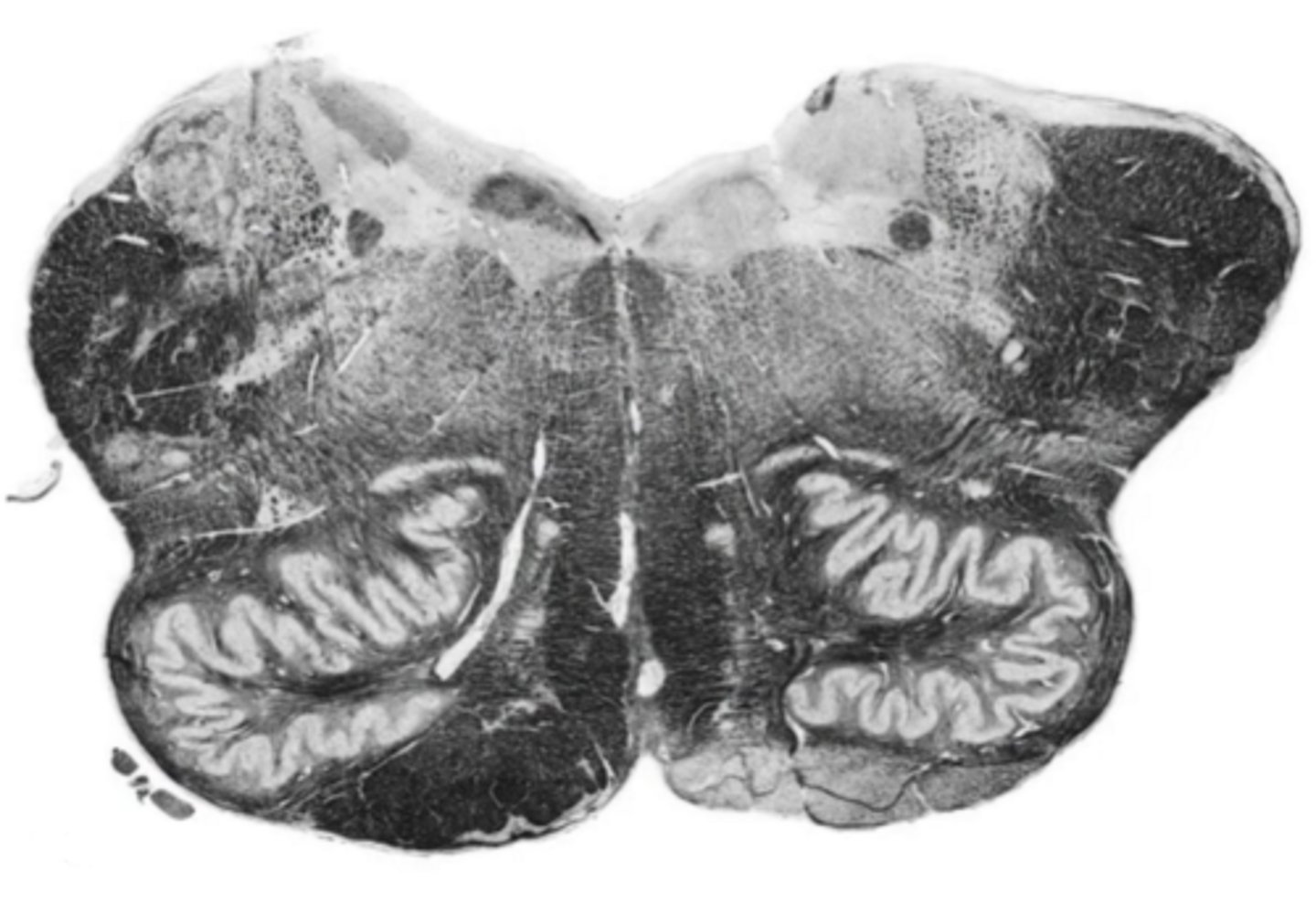 <p>ID the brainstem level</p>