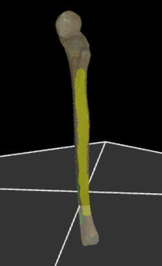 <p>De drie zijden van de ulna.</p>