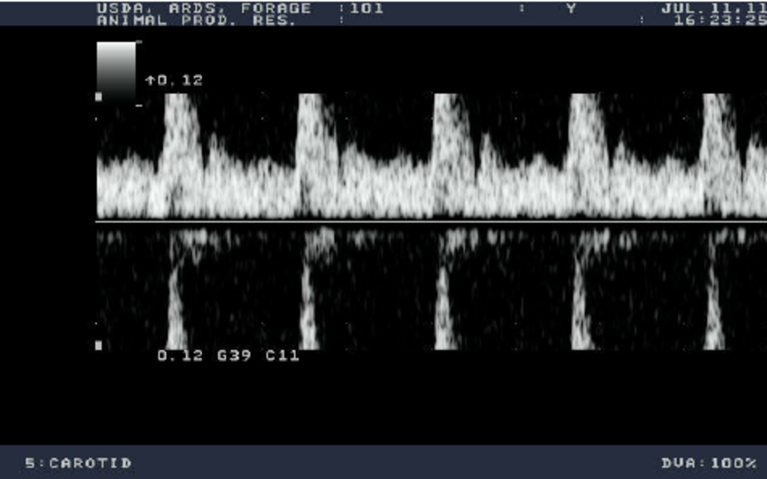 <p>zobrazení horní části spektrální křivky v záporné oblasti grafu</p><ul><li><p>závisí na hodnotě opakovací frekvence</p></li><li><p>omezuje měření vysokých rychlostí - od 4 m/s ho nelze odstranit</p></li><li><p>potřeba najít kompromis mezi maximální hloubkou a maximální měřitelnou rychlostí</p></li></ul><p></p>