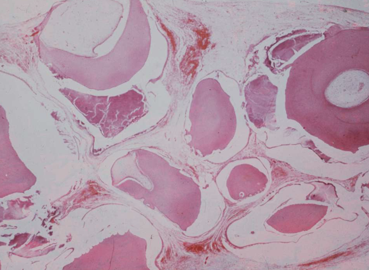 <p>multiple structures resemble small teeth in loose fibrous matrix</p>