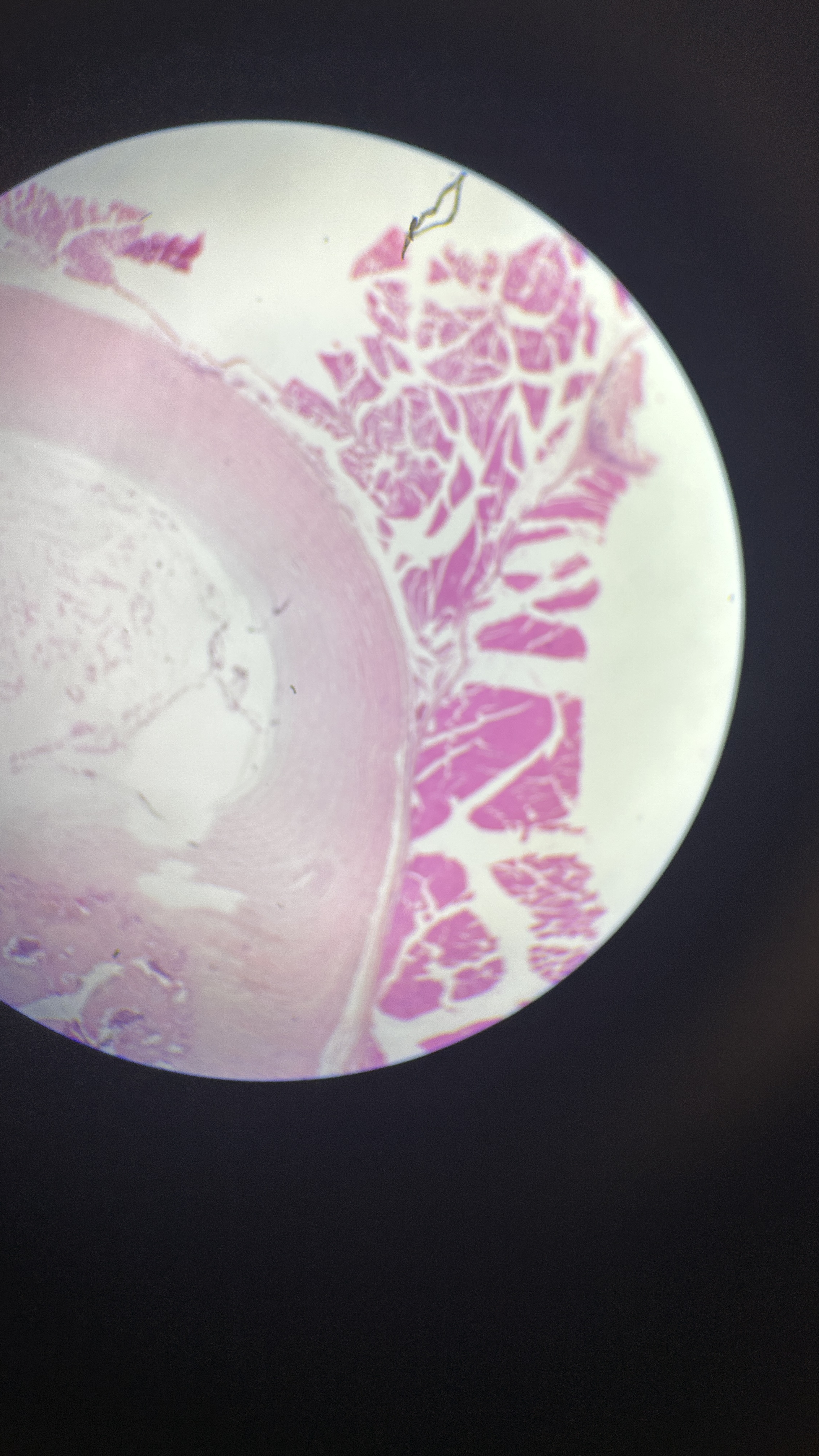 <p>What is the magnification level of the Fibrocartilage?</p>