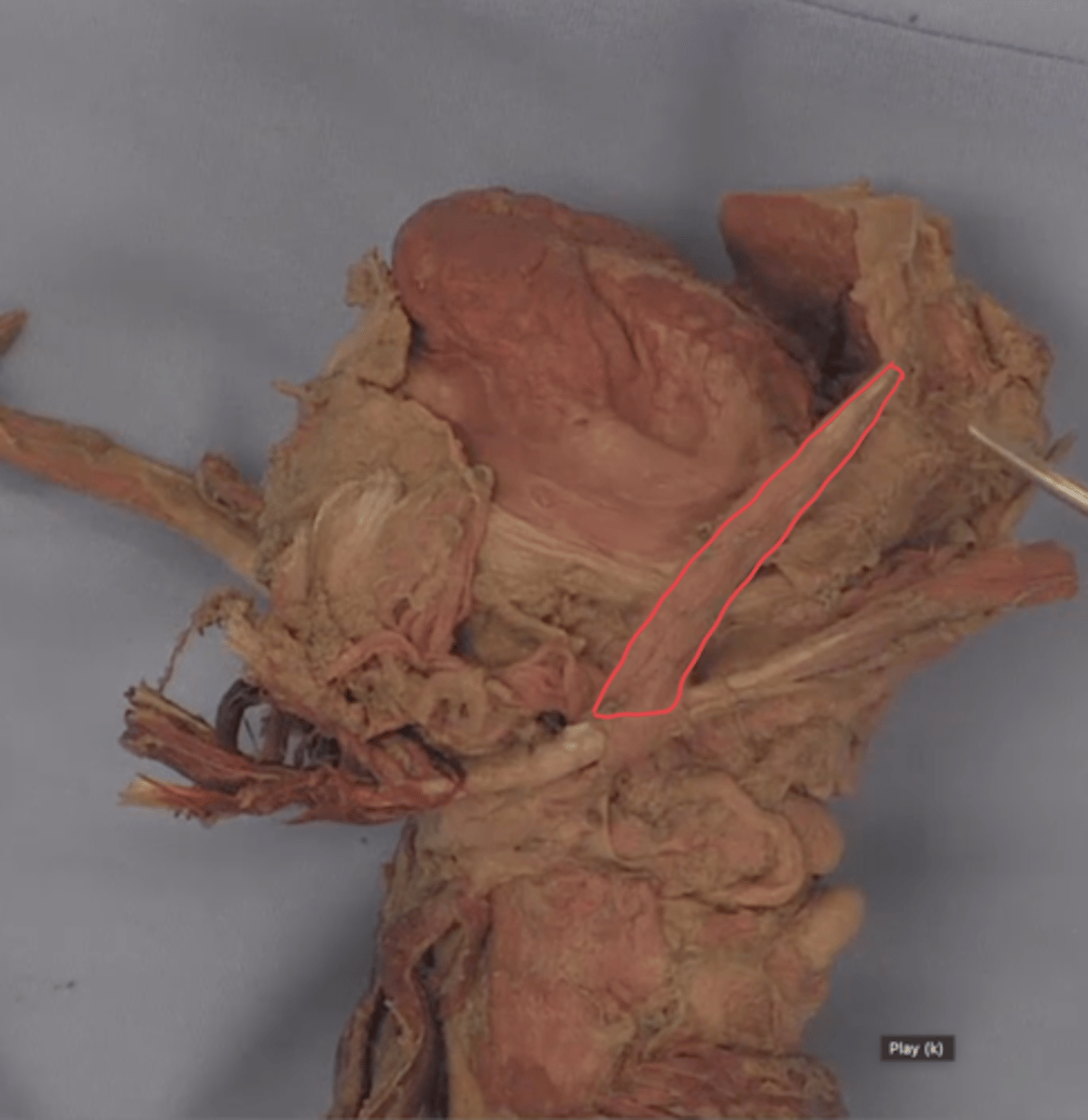 <p>identify this structure</p>